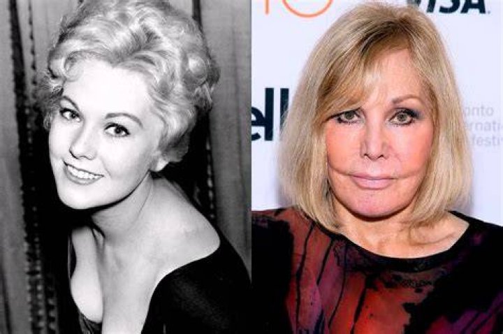 20 Celebrities Whose Plastic Surgeries Went Awry