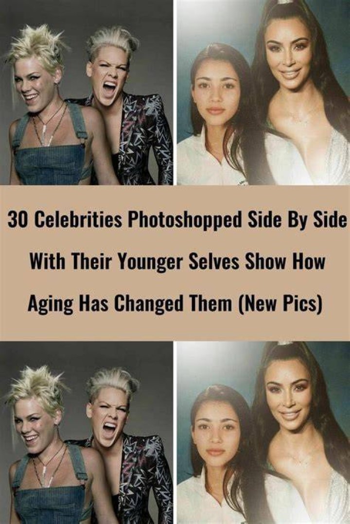 30 Celebrities Who Have Had Plastic Surgery And Injectables Page 4