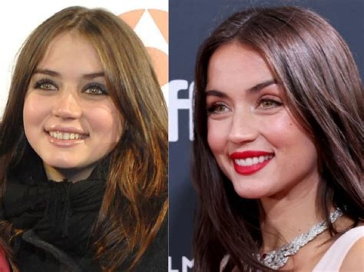 Ana de Armas Before and After Plastic Surgery Nose, Boob