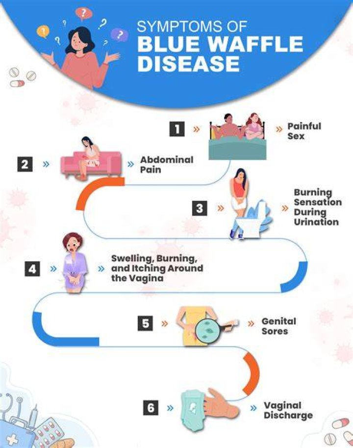 Blue waffle disease Is it a real STD?