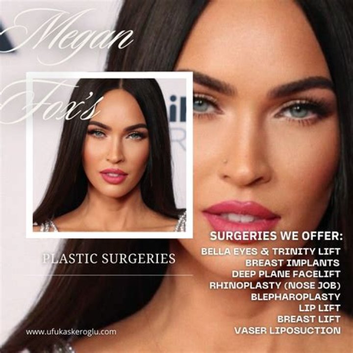 Chatter Busy Megan Fox Breast Implants