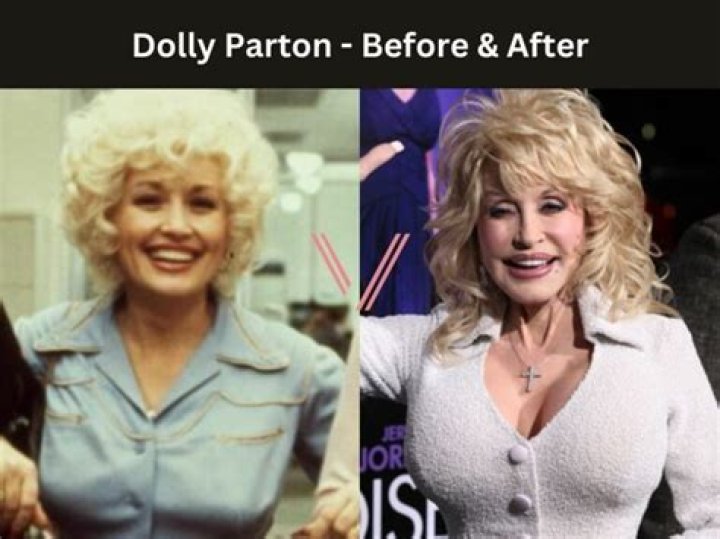 Dolly Parton from Celebrity Breast & Bra Sizes Revealed E! News