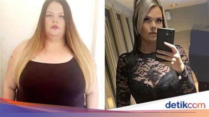 Dulu berbobot 300 kg, wanita ini berhasil turunkan berat badan hingga