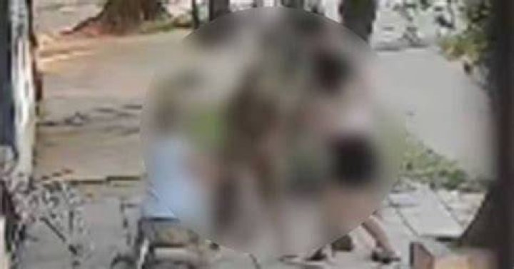 Hombre muere deshebrado su agon&iacute;a dur&oacute; 83 d&iacute;as FOTOS El Ma&ntilde;ana de