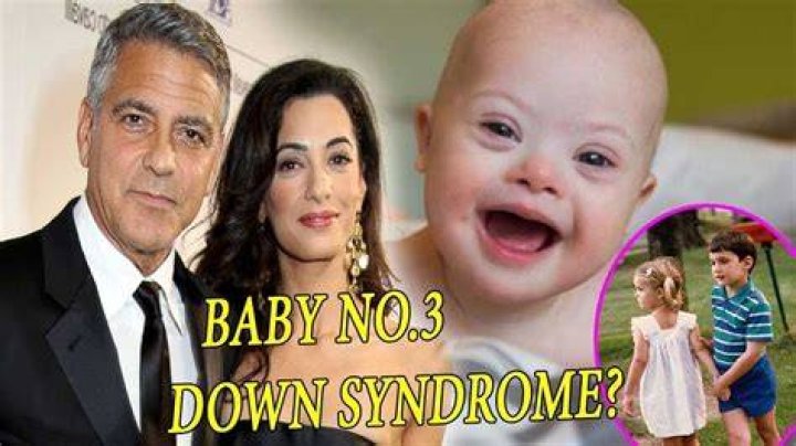 Is Down Syndrome In Clooney's Son A Reality?