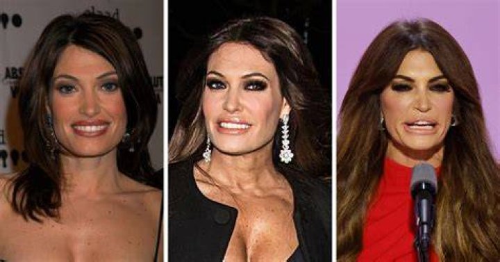 Kimberley Guilfoyle's Transformation: Before And After