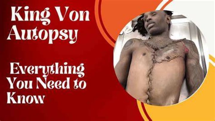 King Von Autopsy Photo