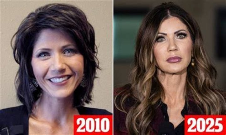 Kristi Noem's Transformation: Before And After
