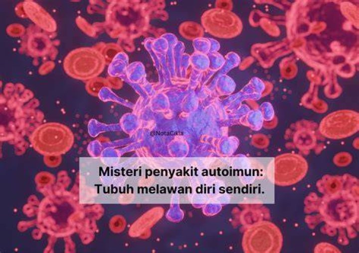 Merungkai Misteri Penyakit “Systemic Lupus Erythematosus” (SLE