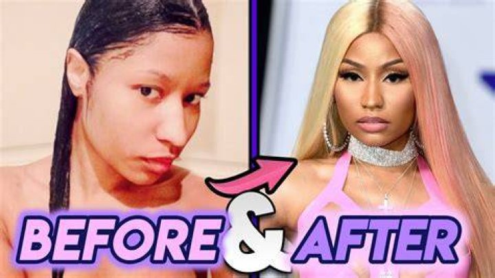 Nicki Minaj Before And After Skin Bleaching