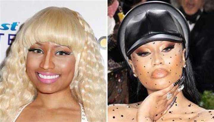 Nicki Minaj Skin Lightening