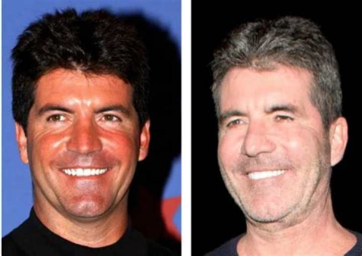 Understanding Simon Cowell's Son Condition: A Journey Through Parenthood