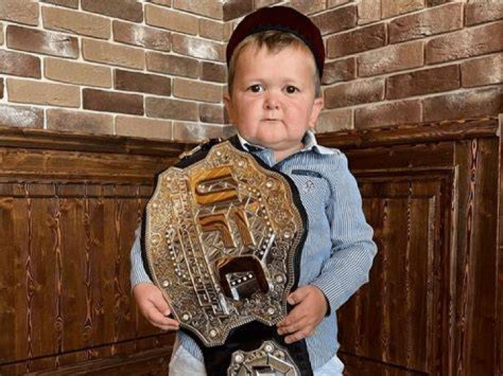 Who is Hasbulla? Real age, UFC contract and his condition explained